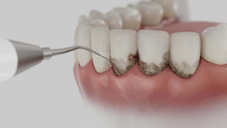 Trusted Tooth Extraction service in Ecru, MS - Dentist Open Now
